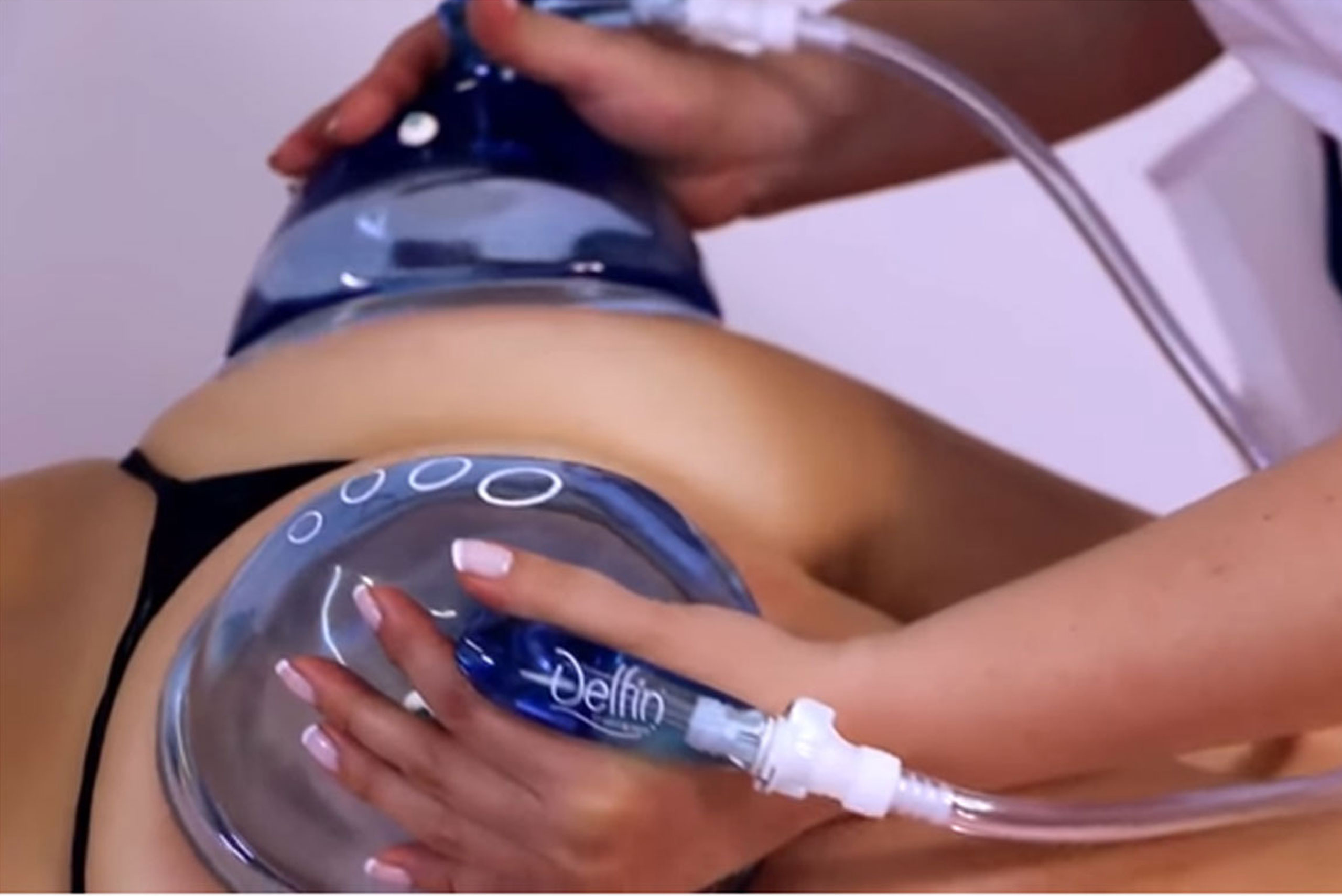 Brazilian Butt Lift Course